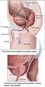 Testosterone Replacement Therapy